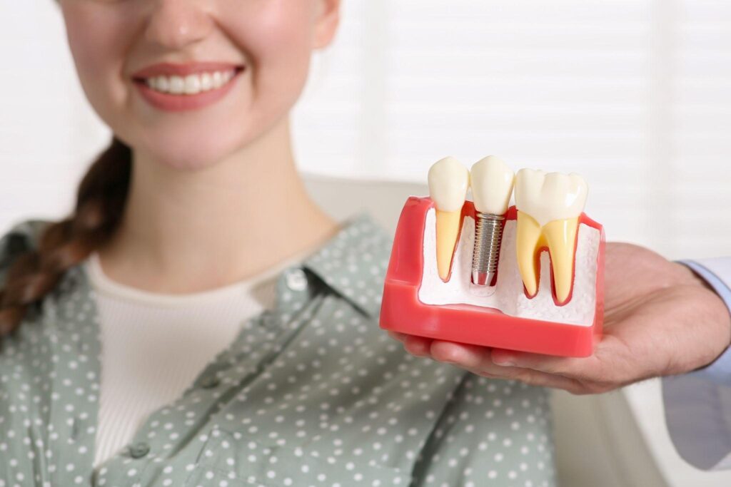 Full Mouth Rehabilitation